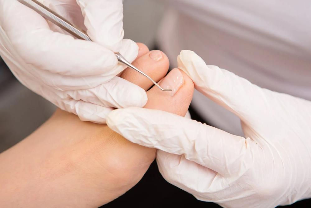 Traitement des affections des ongles
