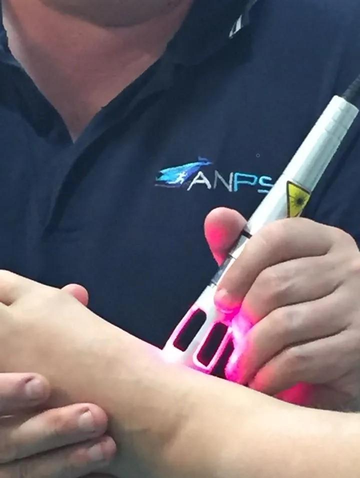 prestation laser